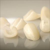 dental-crowns-emax-2