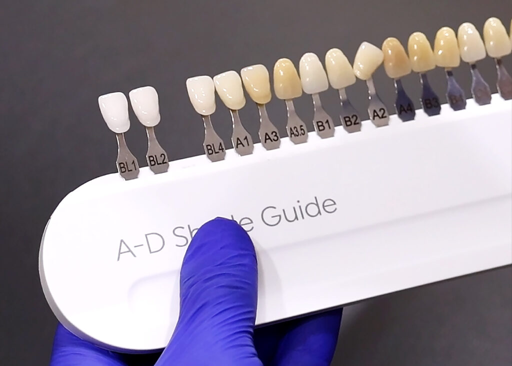 A dental teeth whitening shade guide showing a spectrum of tooth colors arranged from darkest to brightest white.