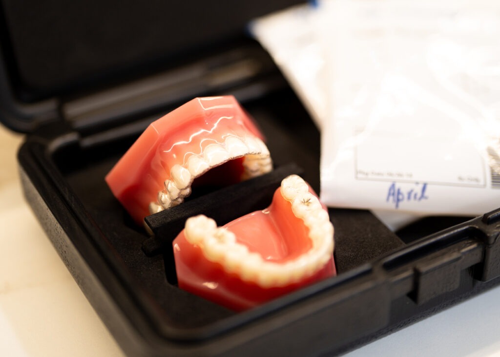 Invisalign available at North Sydney Dentistry