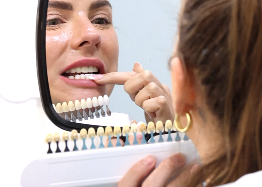 A patient evaluating her smile against a porcelain veneer shade guide in a dental mirror.