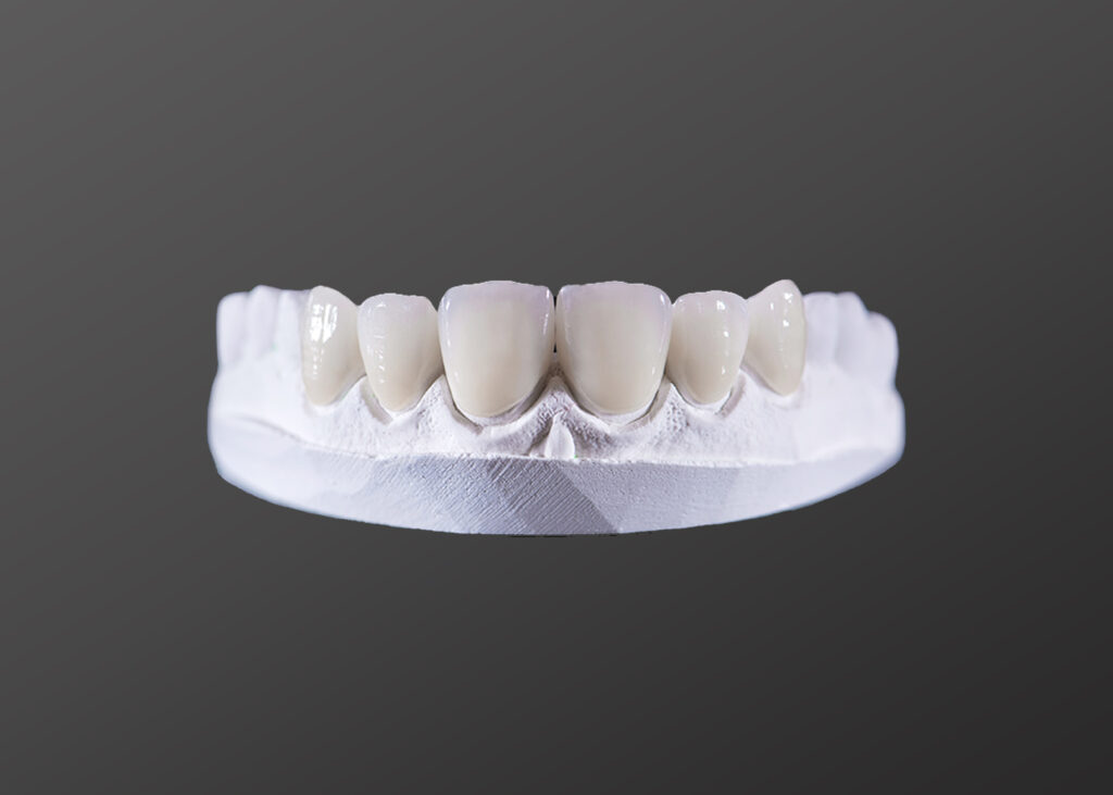Dental Veneers Package