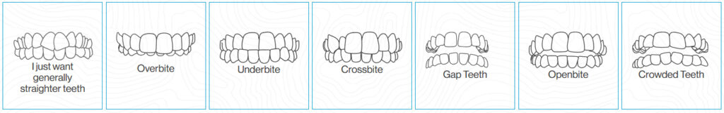 Issues Invisalign can fix