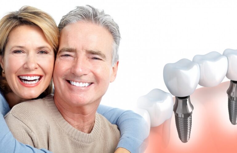 Dental Implants Cost Sydney