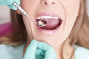 Gentle Dental