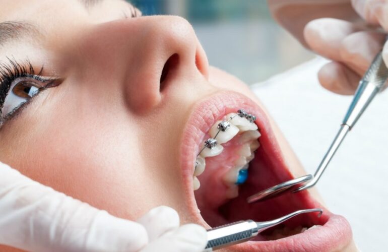 Orthodontist Sydney