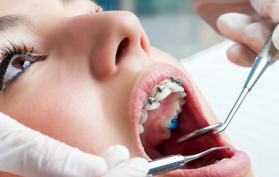 Orthodontist Sydney