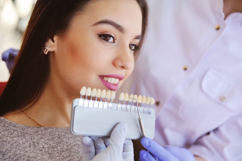 Porcelain Veneers