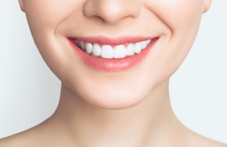 Teeth Whitening Cost