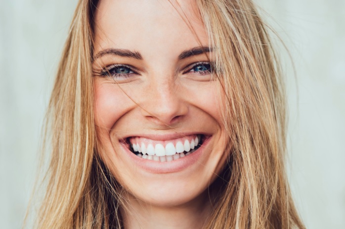 veneers in north sydney