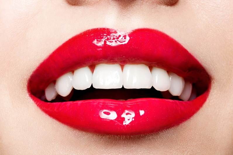 teeth whitening sydney