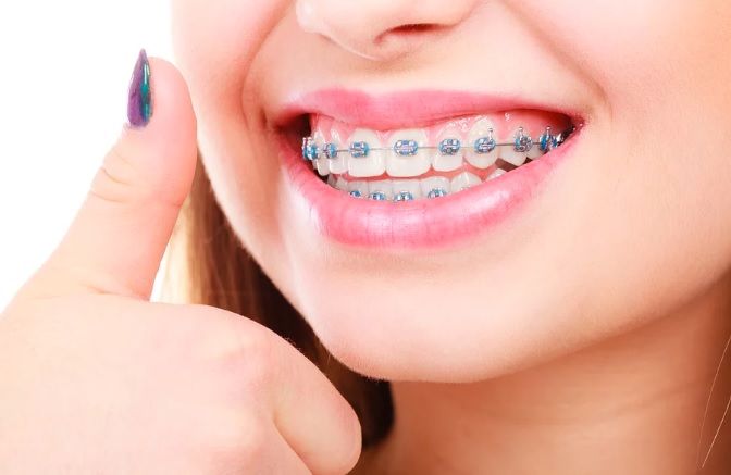 braces cost in north sydney