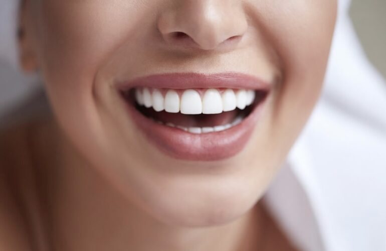 Cosmetic Dentist Sydney