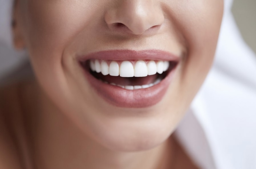 Cosmetic Dentist Sydney