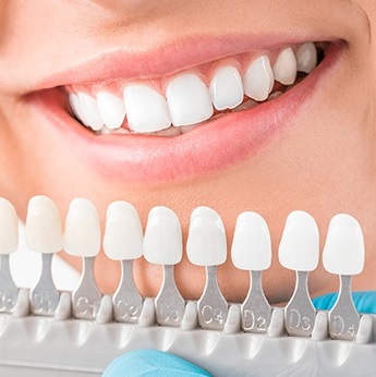 Veneers in North Sydney