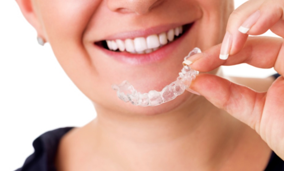 Invisalign cost North Sydney