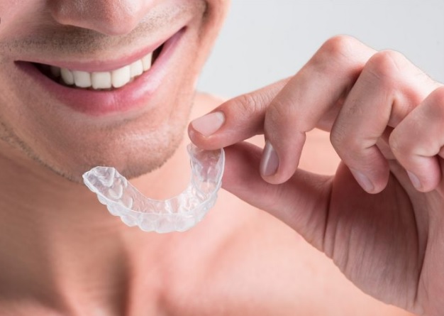 invisalign cost in north sydney