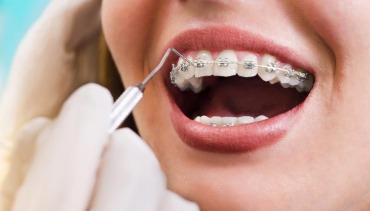 orthodontics north sydney